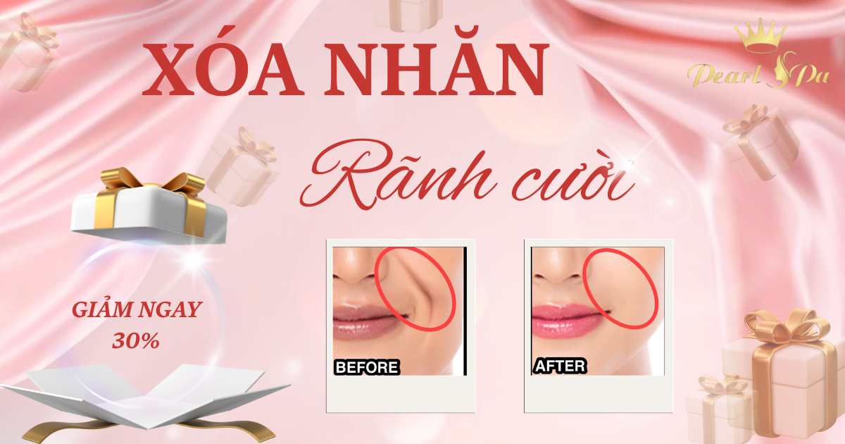 xoa-nhan-ranh-cuoi-vinhomes