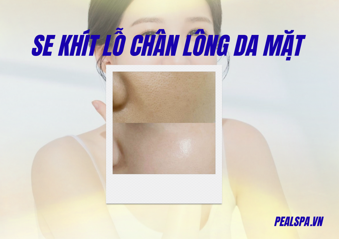 Se Khít Lỗ Chân Lông Da Mặt Tại Quận 2