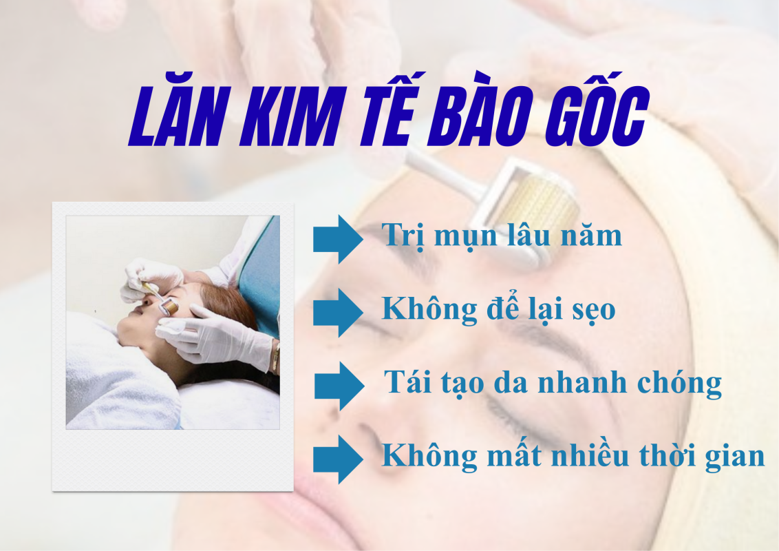 Lăn Kim Tế Bào Gốc Tại Quận 2
