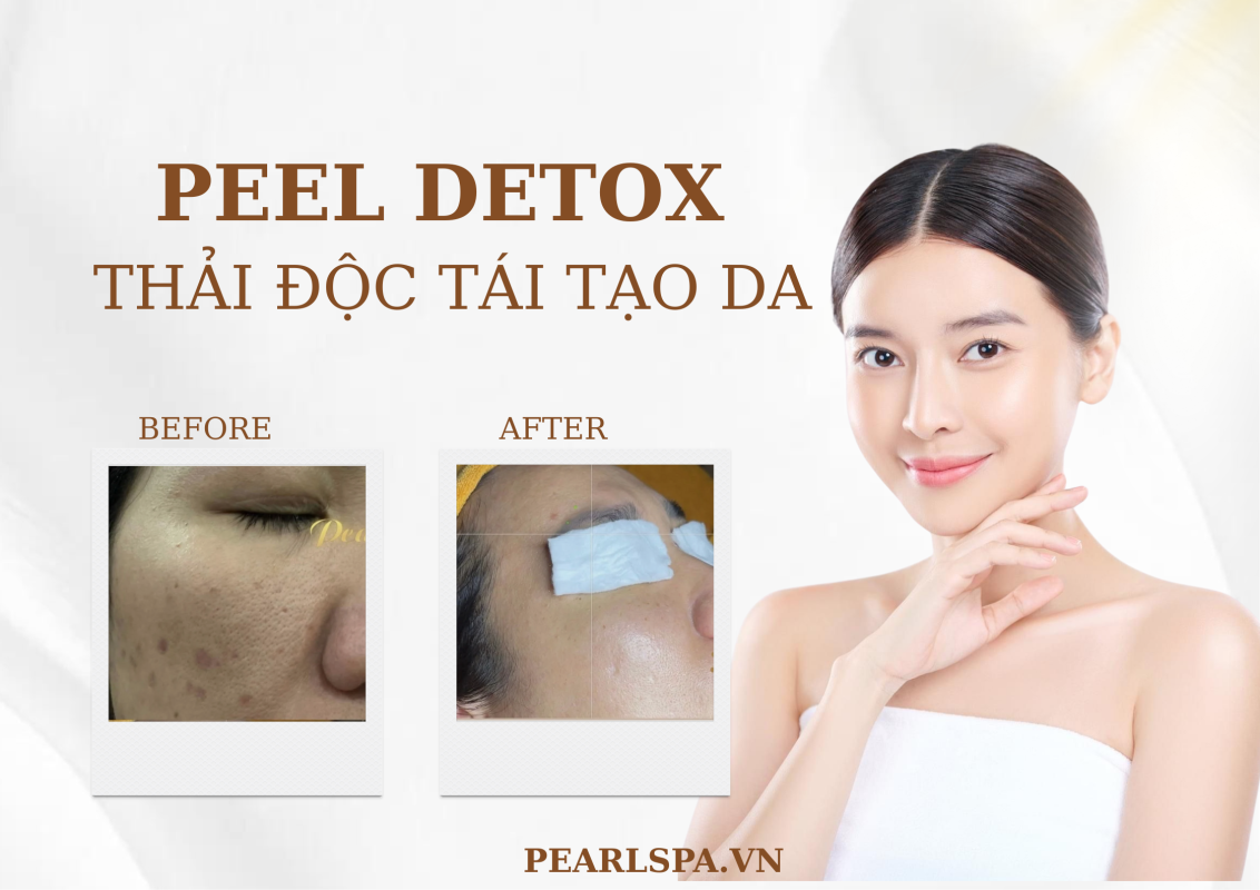 Detox Da Tại Quận 2