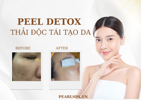 Detox Da Tại Quận 2